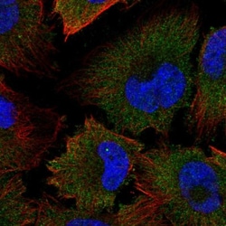 Calpain 2 Antibody, Novus Biologicals 0.1mL; Unlabeled:Antibodies, Polyclonal